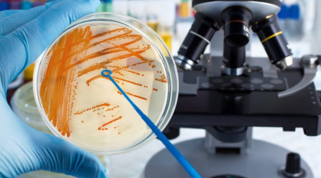 ẢNH HƯỞNG CỦA VI SINH VẬT